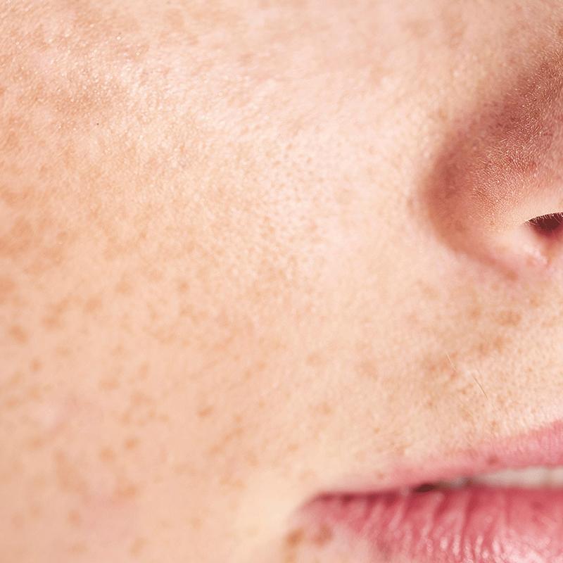 Choosing the Right⁣ Ingredients for Sensitive Skin Comfort