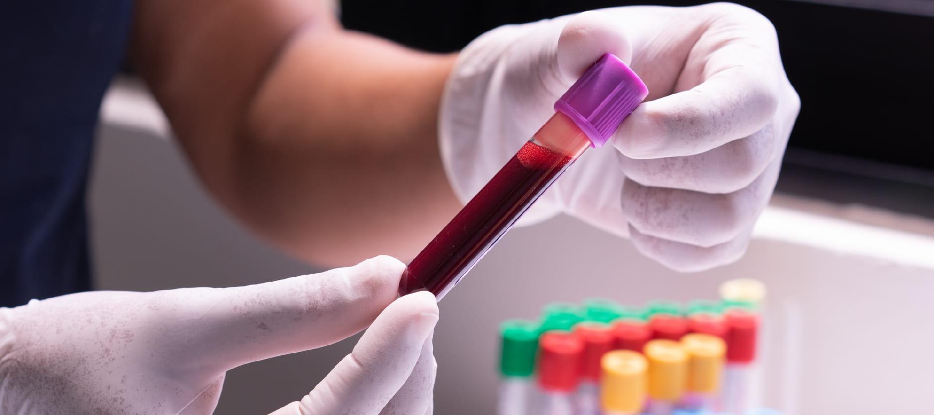 Blood Testing: The Key to ‍Understanding Your Unique Nutritional Needs