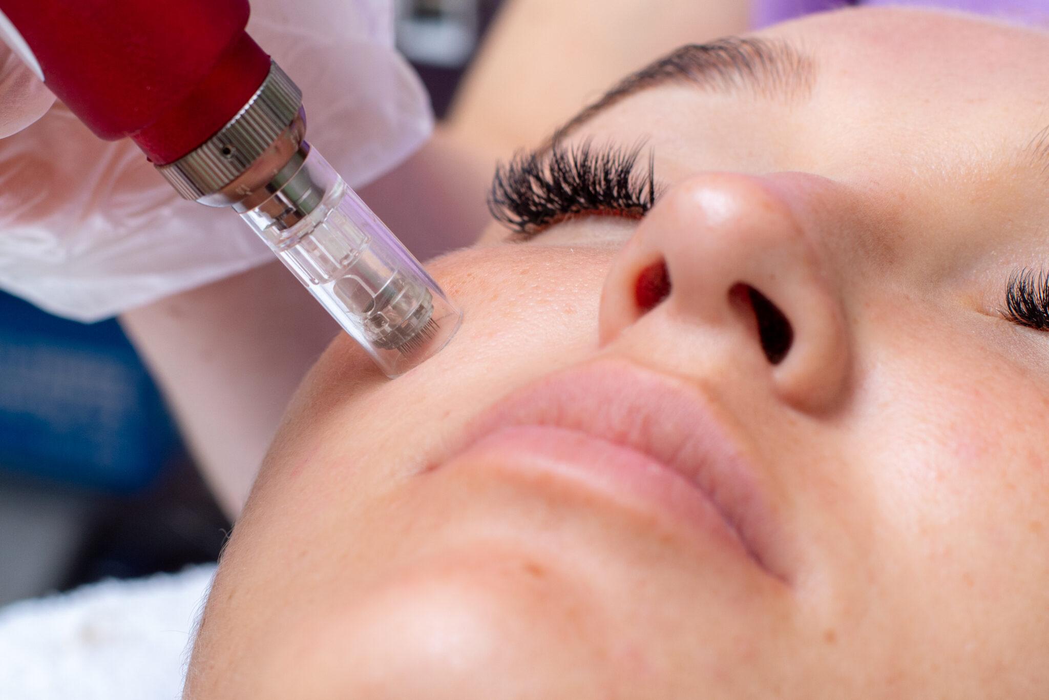 1. Understanding ‍Microneedling: The Science Behind⁢ Enhanced Collagen‌ Production